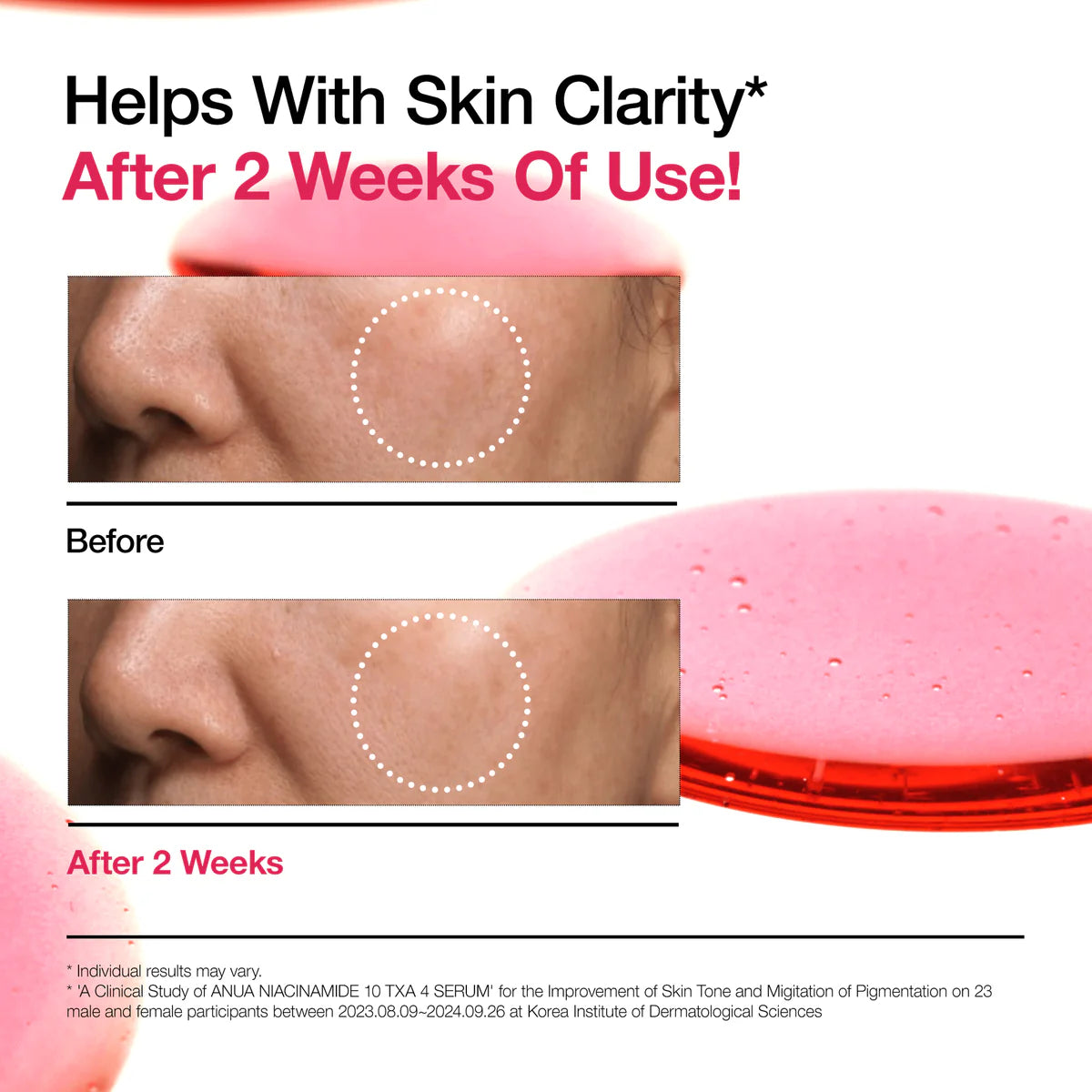 Anua Niacinamide Serum